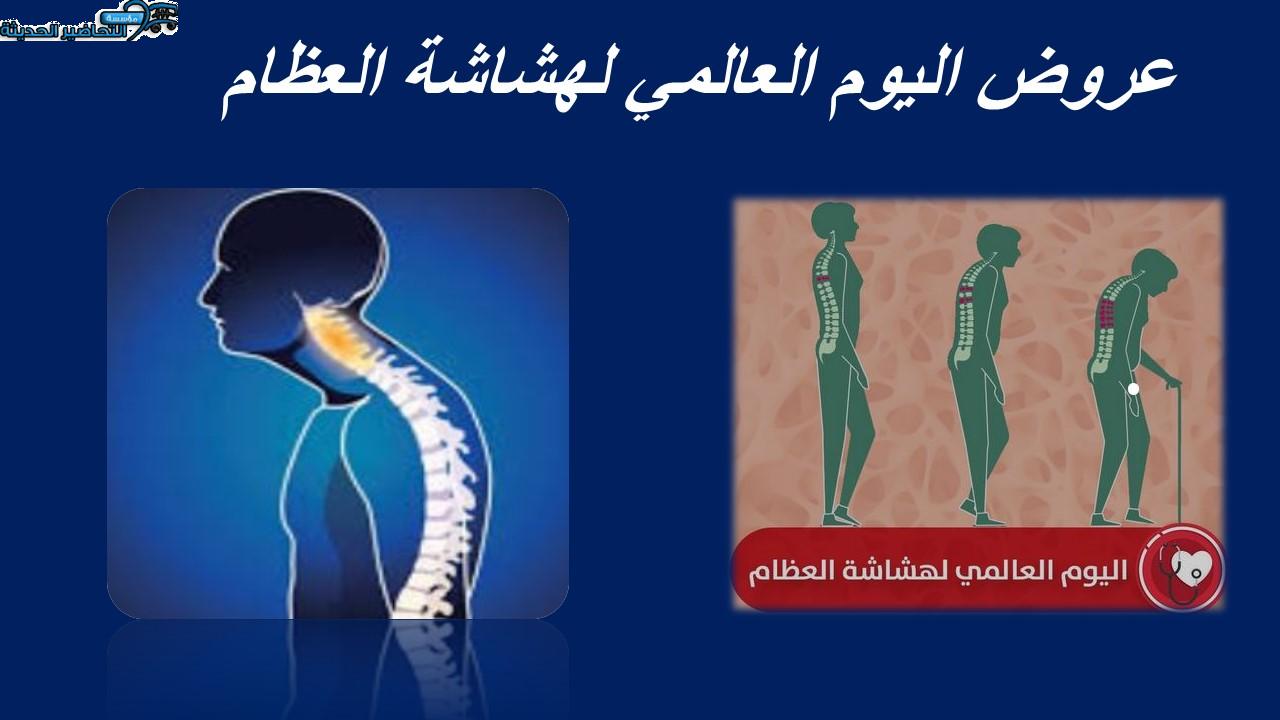 عروض اليوم العالمي لهشاشة العظام